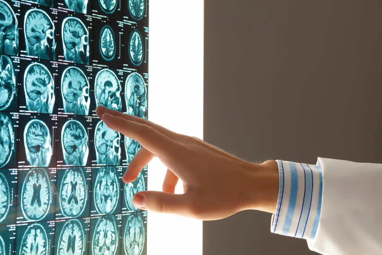 Brain Injuries from Medical Malpractice